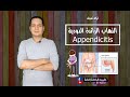 ازاى تعرف حالة التهاب الزائدة الدودية فى الطوارئ /appendicitis