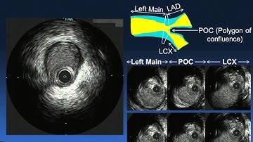 Evaluation of Left Main Stenosis