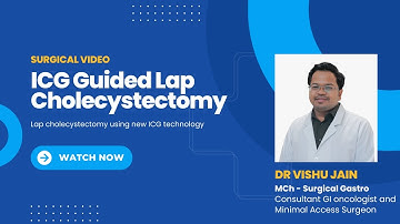 ICG guided Laparoscopic cholecystectomy | Dr Vishu Jain | GI oncologist and Minimal access surgeon