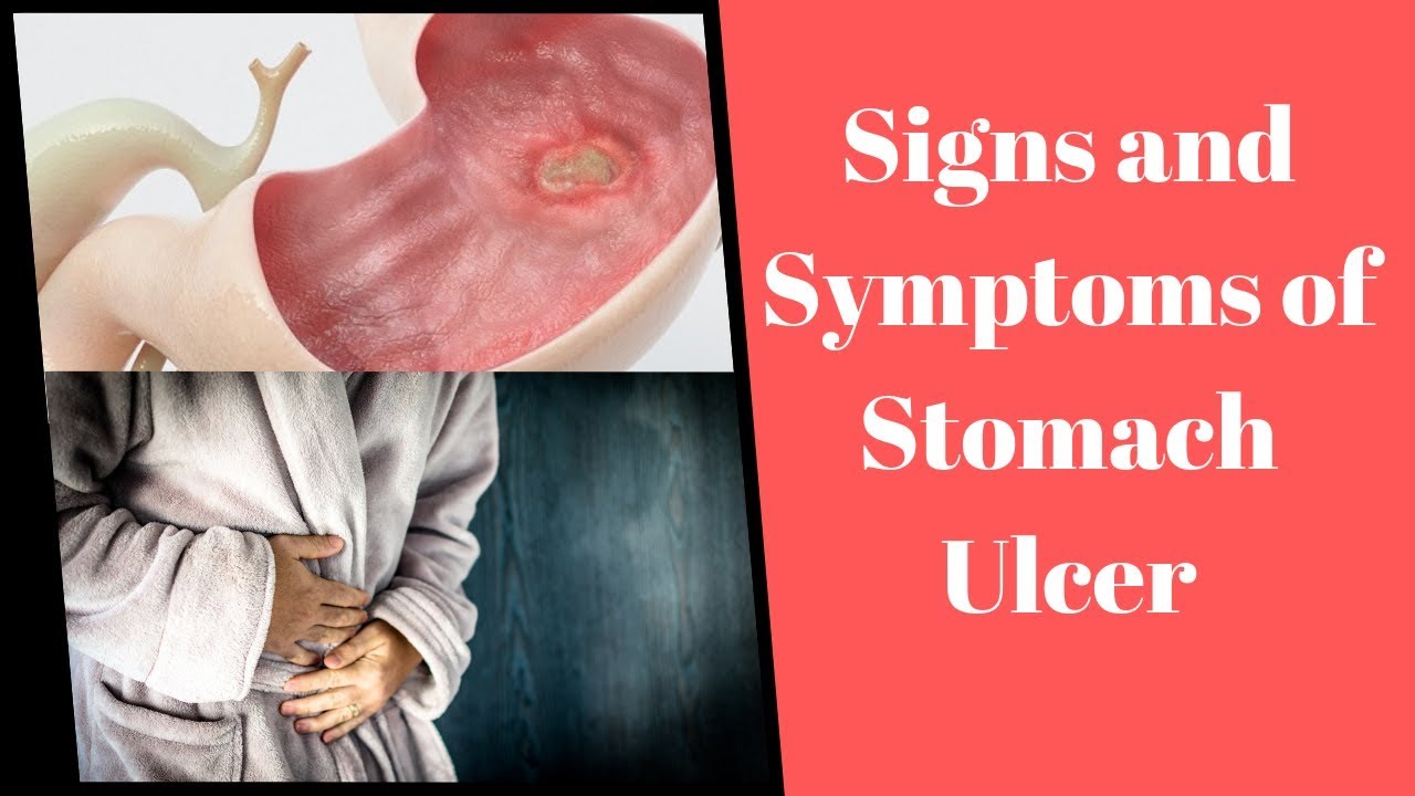symptoms of stomach ulcer