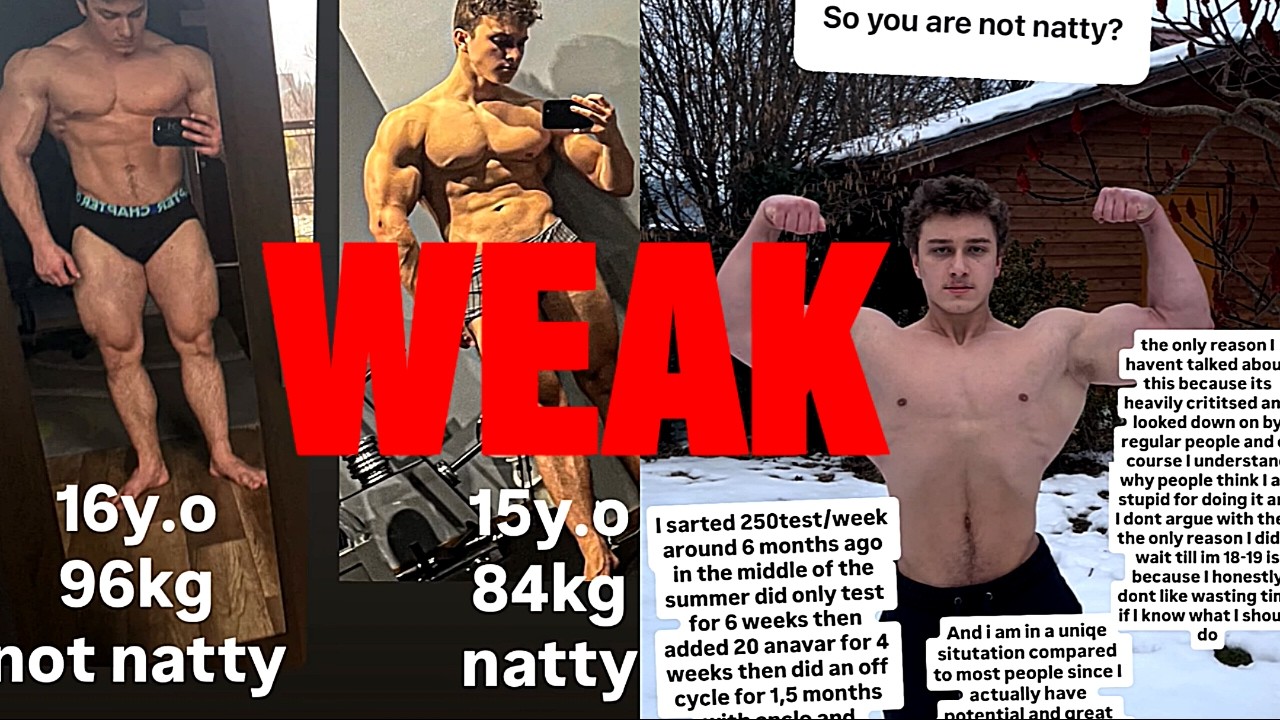 These Genetics Deserved Steroids - 16 year old