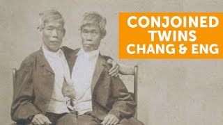 World Famous Conjoined Twins, Chang and Eng Bunker