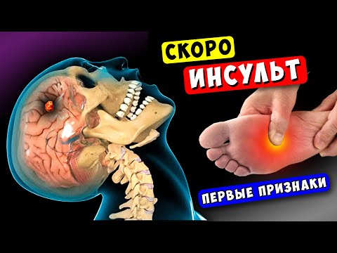 8 Признаков скорого ИНСУЛЬТА! Тело предупреждает, НЕ Пропусти - ВЫЖИВЕШЬ