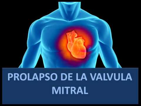 Video: ¿El prolapso de la válvula mitral empeora con la edad?