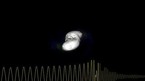 Binary neutron star merger