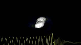 Binary neutron star merger