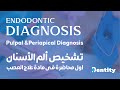 اول محاضرة في مادة علاج العصب Endodontic Diagnosis 