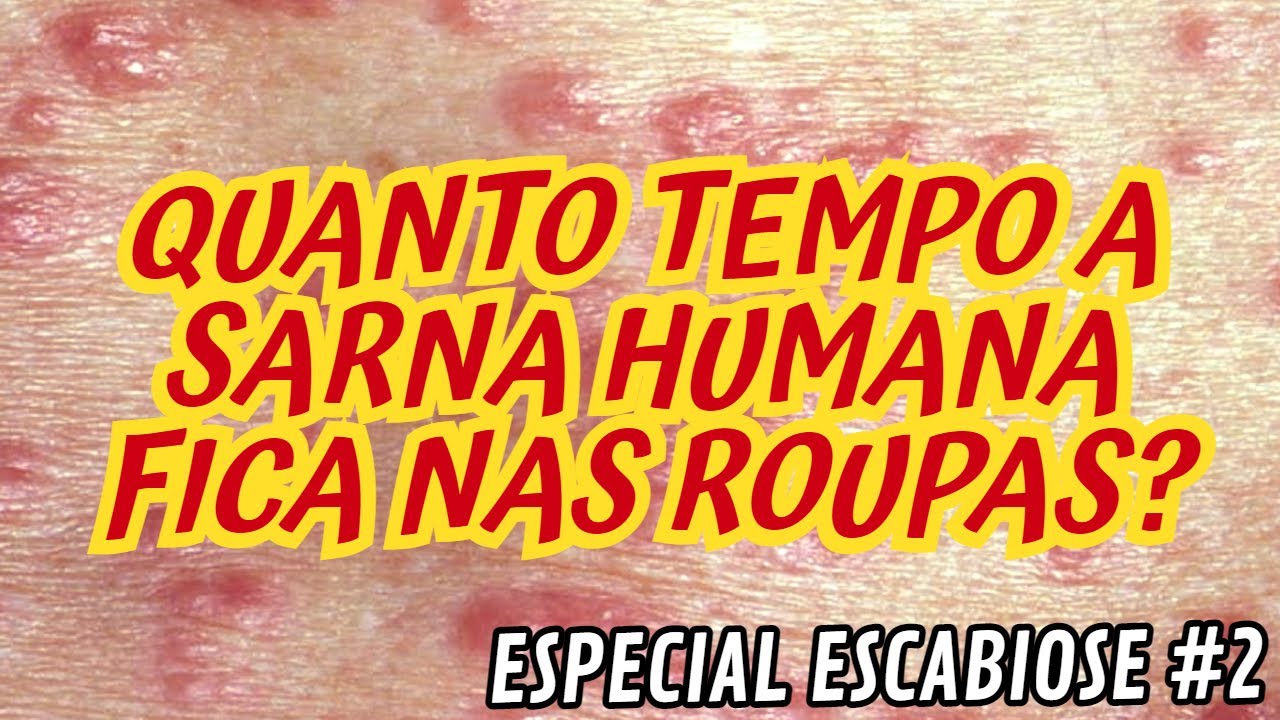 QUANTO TEMPO A SARNA HUMANA FICA NAS ROUPAS? - ESPECIAL ESCABIOSE #2 ...