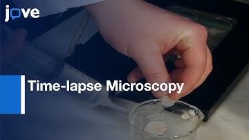 Time-lapse Microscopy and Longitudinal Data in Anti-cancer Therapy | Protocol Preview