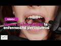Signos y síntomas de la enfermedad periodontal