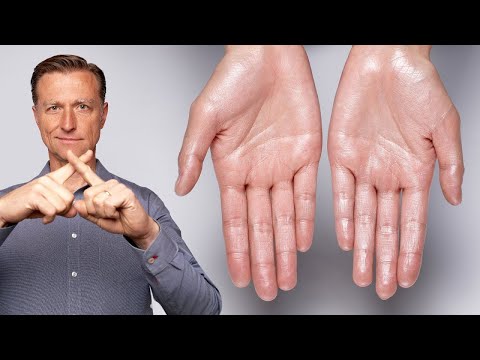 Hyperhidrose : Qui Souffre de transpiration excessive - TRAITEMENT - Dr Eric Berg