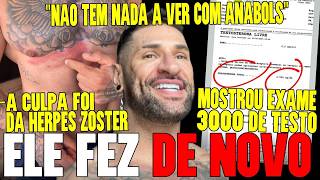 POBRE LOCO JÁ VOLTOU A USAR ANABOLS