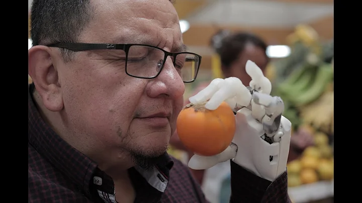 The PSYONIC advanced bionic hand