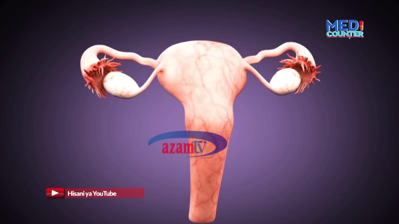 Ujauzito usiokuwa na mtoto (Mimba Hewa) inawezekanaje? Tazama Medicounter