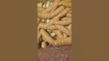 وجود حشرات بداخل الأذن 