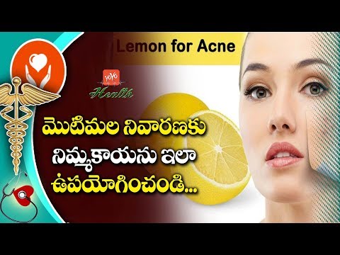 Lemon For Pimples Treatment |Tips To Remove Pimples | Lemon For Acne | Skin Care | YOYO TV Health