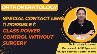 Contact Lens से रोक सकते हैं चश्में का नंबर : Orthokeratology