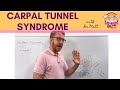 Carpal Tunnel Syndrome