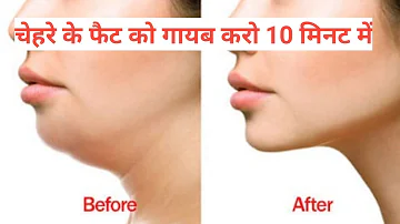 फेस का फैट, डबल चिन गायब Reduce Face Fat in 7 Days , No More Double Chin, Chubby Cheeks