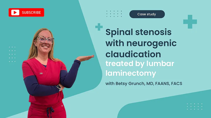Case study 63- Lumbar degenerative spinal stenosis treated w/lumbar laminectomy explained by surgeon