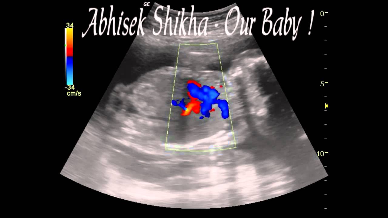 Baby's Heartbeat Our Baby Six Months YouTube