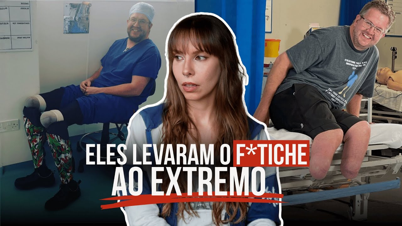 O cirurgião que tinha f*tiche em amputação