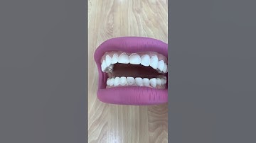 GIANT FALSE TEETH 🦷#asmr #funnyvideo #trending #viral #shorts