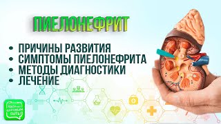 Пиелонефрит | Всегда ли сопровождается болью?