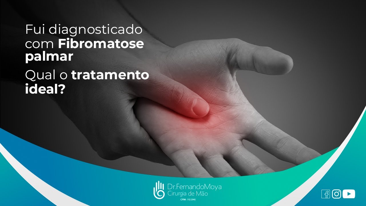 fui-diagnosticado-com-fibromatose-palmar-qual-o-tratamento-ideal-dr