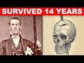 Bizarre Survival Stories That Will Keep You on the Edge of Your Seat