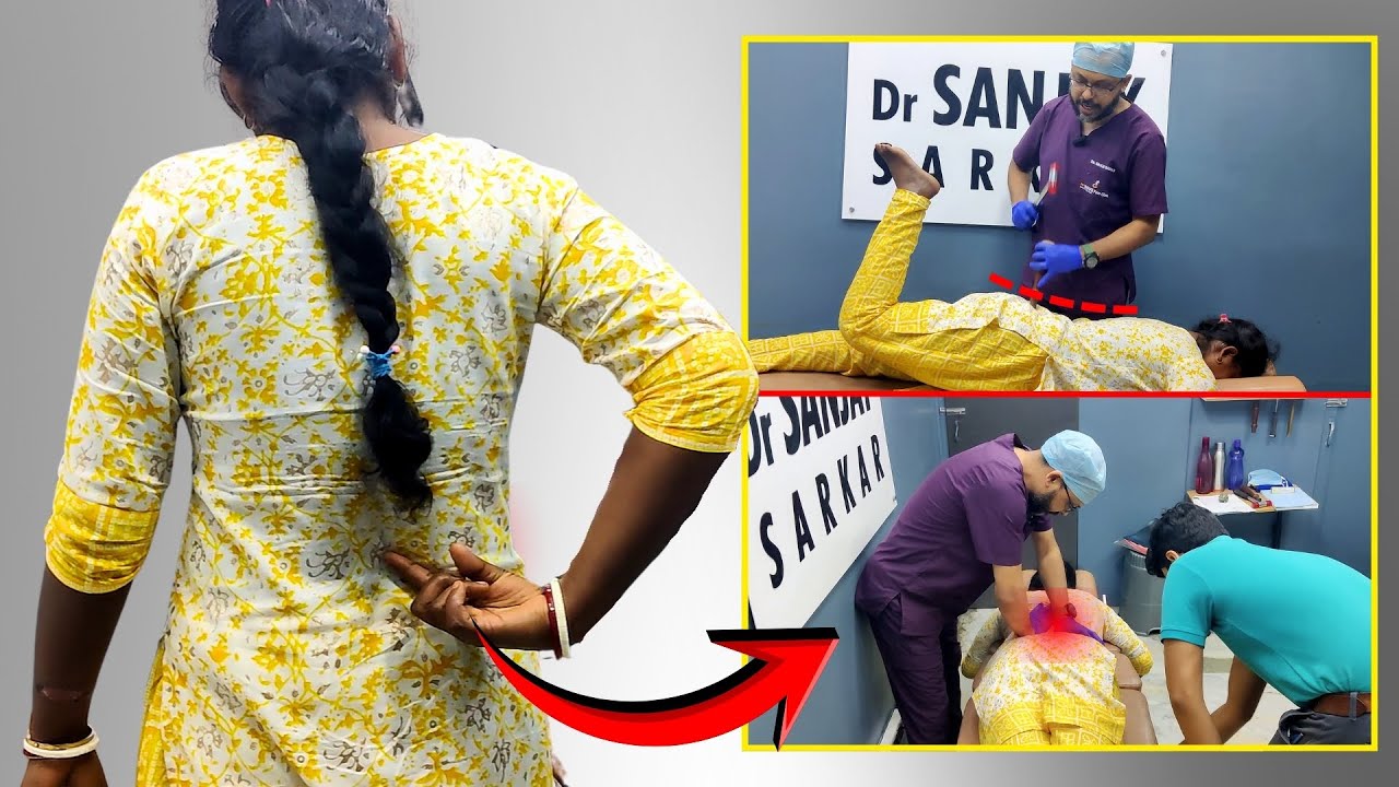 Мышечные спазмы в области поясницы в течение года? Спазм квадратной мышцы поясницы вылечен мануал...