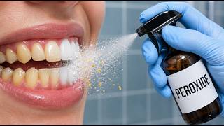 9 Things Dentists Don't Want You to Know About Hydrogen Peroxide and Your Teeth Should You Use Hydrogen Peroxide As Mouthwash Dentist Explains The Risks Dental Team Fl