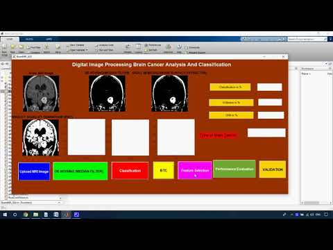Brain Tumor Detection from MRI Image using Digital Image Processing