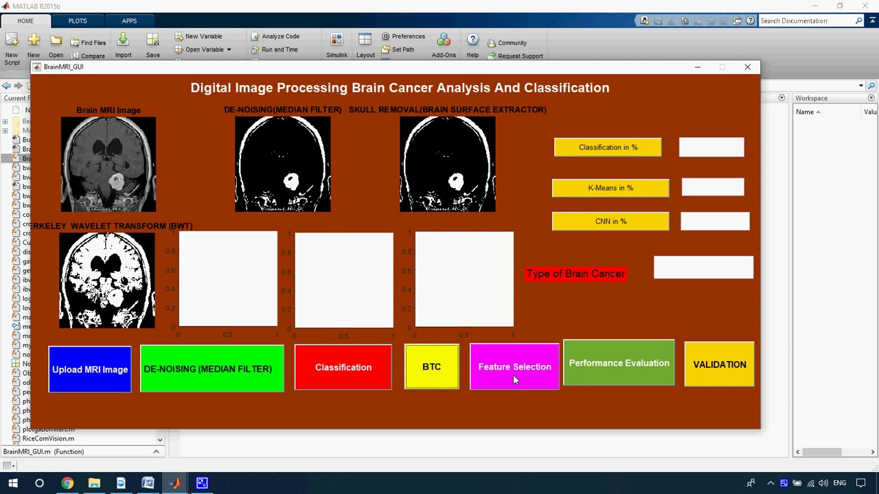 Brain Tumor Detection from MRI Image using Digital Image Processing