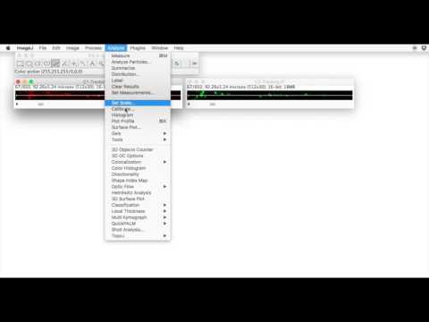 FIJI for Quantification: Kymograms