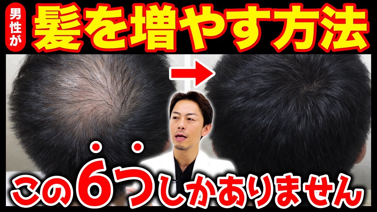 【医師解説】髪の毛を増やす正しい方法｜育毛剤・発毛剤・AGA治療・再生医療の全知識