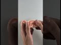 Custom Silicone Ear Prosthetics #CustomProsthetics #SiliconeProsthetics #ProstheticSolutions