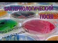 Бактериологический посев в лаборатории, как подготовиться, зачем нужно, и что вы получите в итоге.