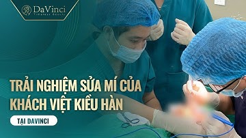 Việt Kiều Hàn Quốc Review trải nghiệm Sửa Mí  tại VTM Davinci