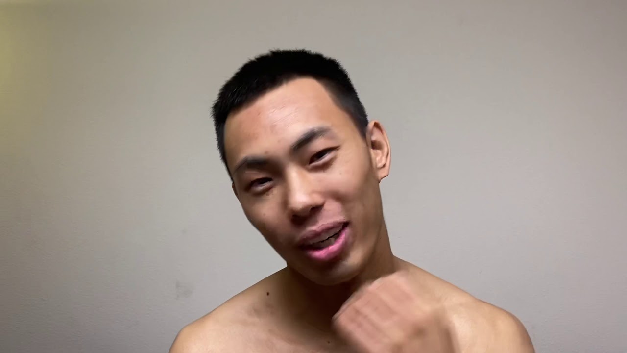 Gua Sha , Cupping & Acupuncture YouTube