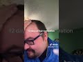 day 12 of restoring my hairline