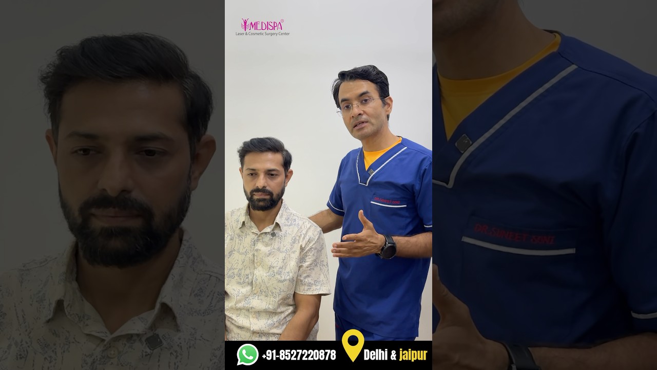 5000 Grafts Advanced Hair Transplant Results by Dr Suneet Soni at Medispa