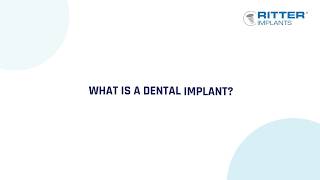 Why Choose Dental Implants? | Tooth Replacement Explained screenshot 4