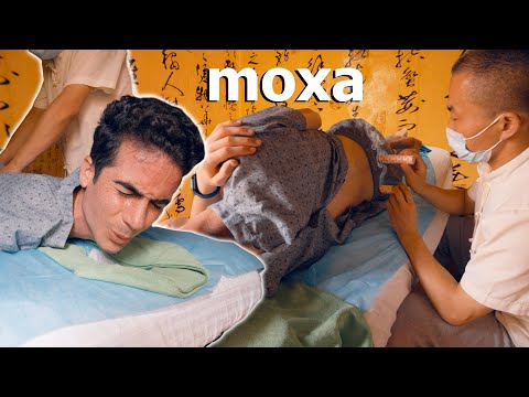 ASMR: HO PROVATO LA MOXIBUSTIONE CON MASSAGGIO CINESE IN ESTATE!