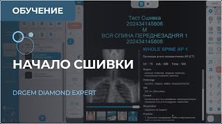 Начало процесса сшивки рентгеновских снимков. Рентген-аппарат DRGEM DIAMOND. Часть 7 screenshot 5