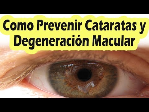 COMO PREVENIR LAS CATARATAS Y DEGENERACION MACULAR Alimentos Para Mejorar La Vista