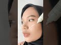 Cindynal skin cream freckle removal dapat menghilangkan flek hitam membandel