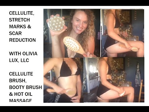 How to Reduce [Cellulite] [Stretch Marks] [Scars] Naturally with Hot Oil &  Olivia Lux Body Brushes