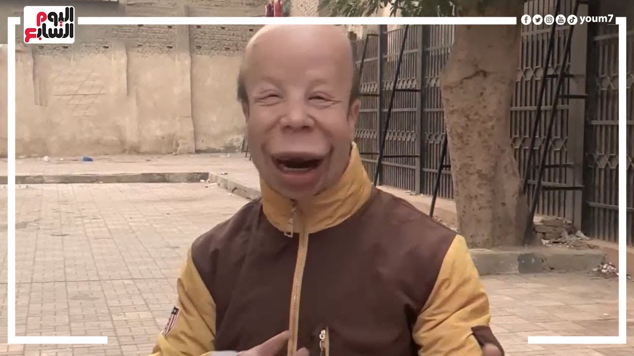 اتريقوا عليا عشان شكلي غريب ومبقاش يفرق معايا الناس.. قصة حسام بوجي