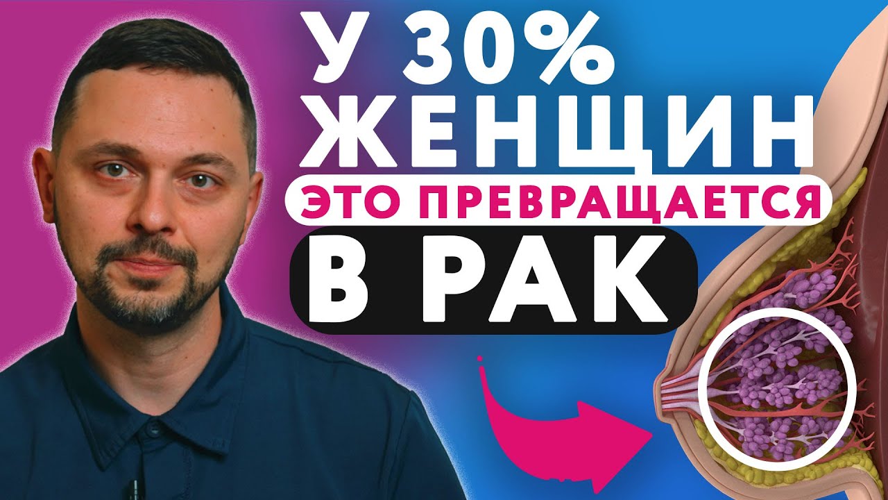 ВСЕ О МАСТОПАТИИ МОЛОЧНОЙ ЖЕЛЕЗЫ / Причины и Симптомы мастопатии ...